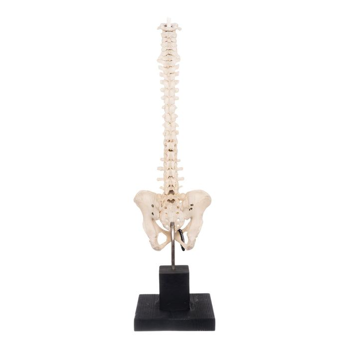 Real Human Spine and Pelvis on Stand