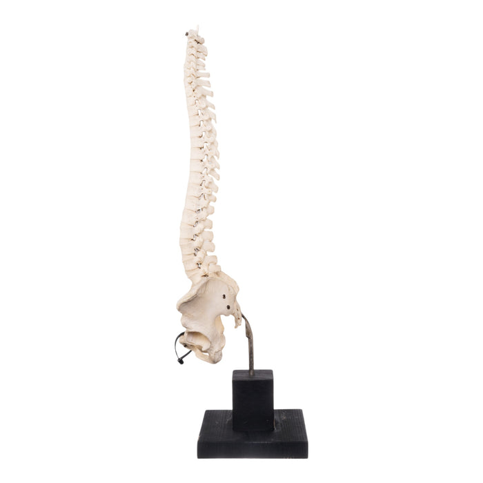 Real Human Spine and Pelvis on Stand