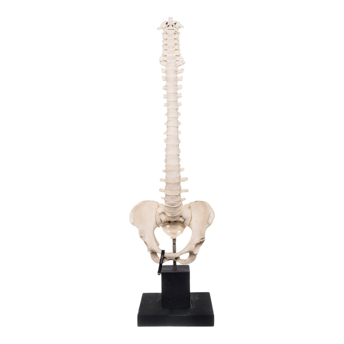 Real Human Spine and Pelvis on Stand