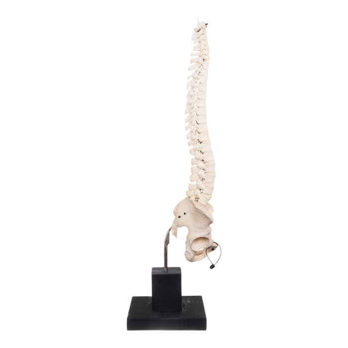 Real Human Spine and Pelvis on Stand