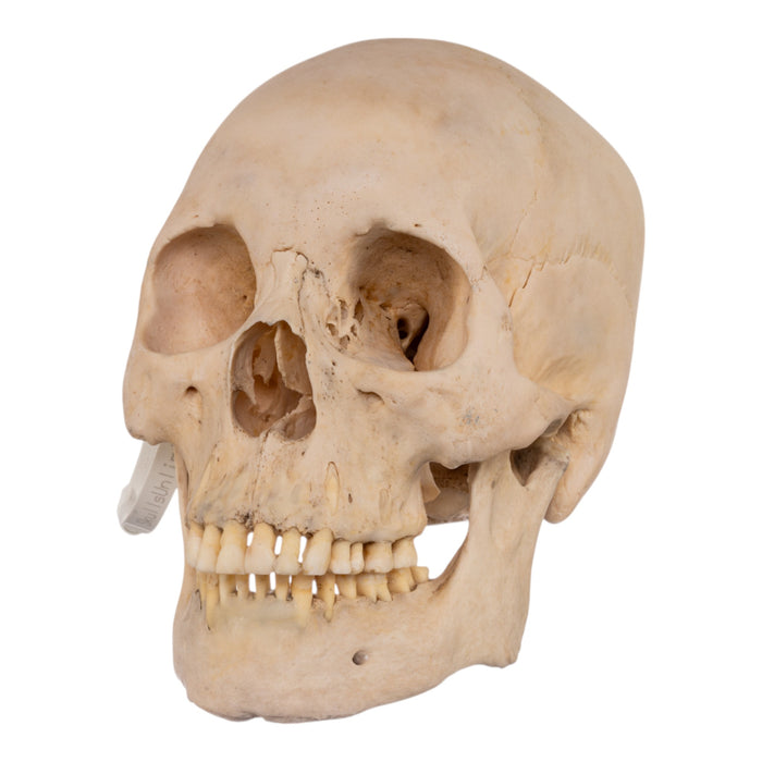 Real Human Skull