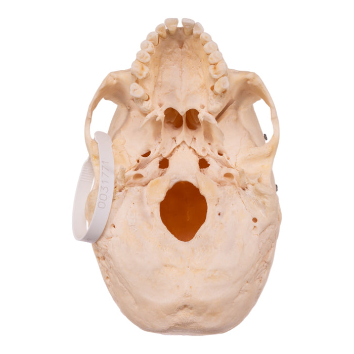 Real Half Human Skeleton - Disarticulated