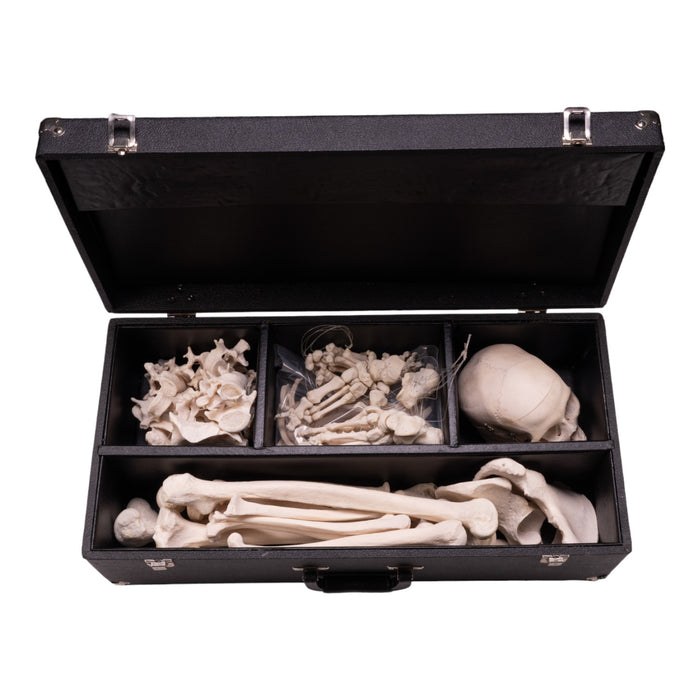 Real Human Skeleton - Disarticulated with Carrying Case