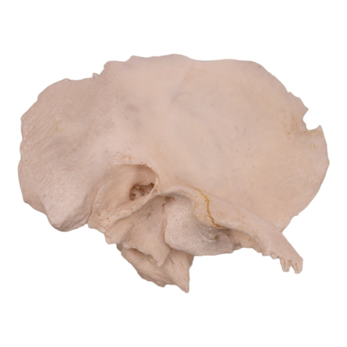 Real Human Right Temporal Bone