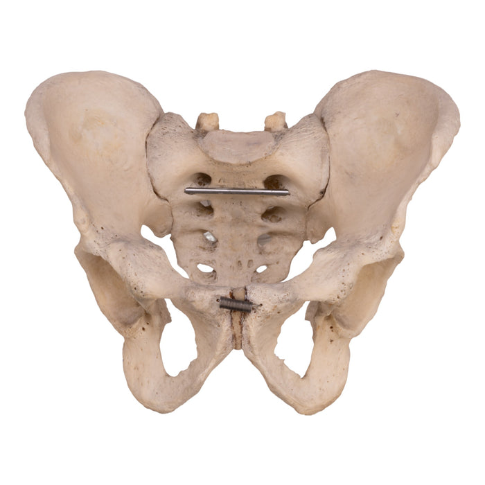 Real Human Pelvis, Sacrum, and Coccyx - Articulated