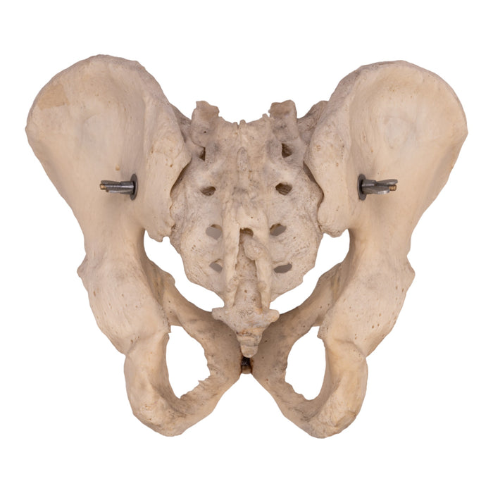 Real Human Pelvis, Sacrum, and Coccyx - Articulated