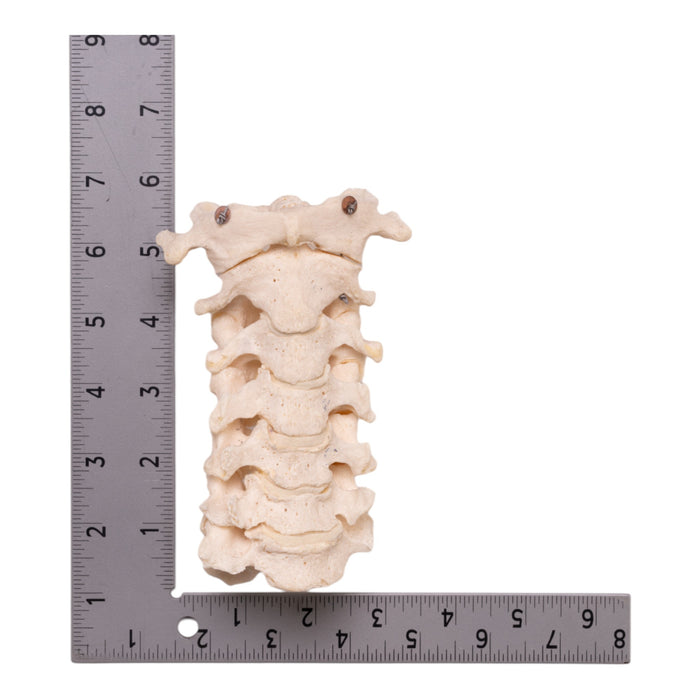 Real Human Neck Bones - Articulated