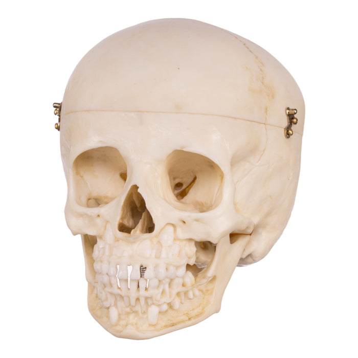 Replica Human Child Skull - 6-year-old with Exposed Dentition