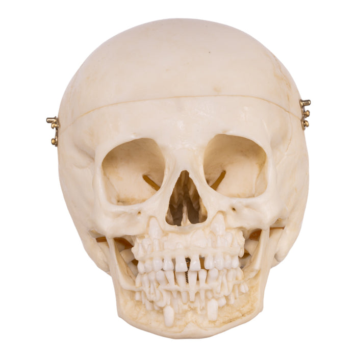 Replica Human Child Skull - 6-year-old with Exposed Dentition