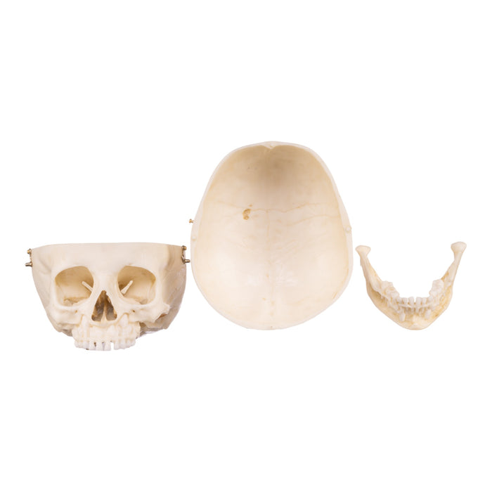 Replica Human Child Skull - 6-year-old with Exposed Dentition