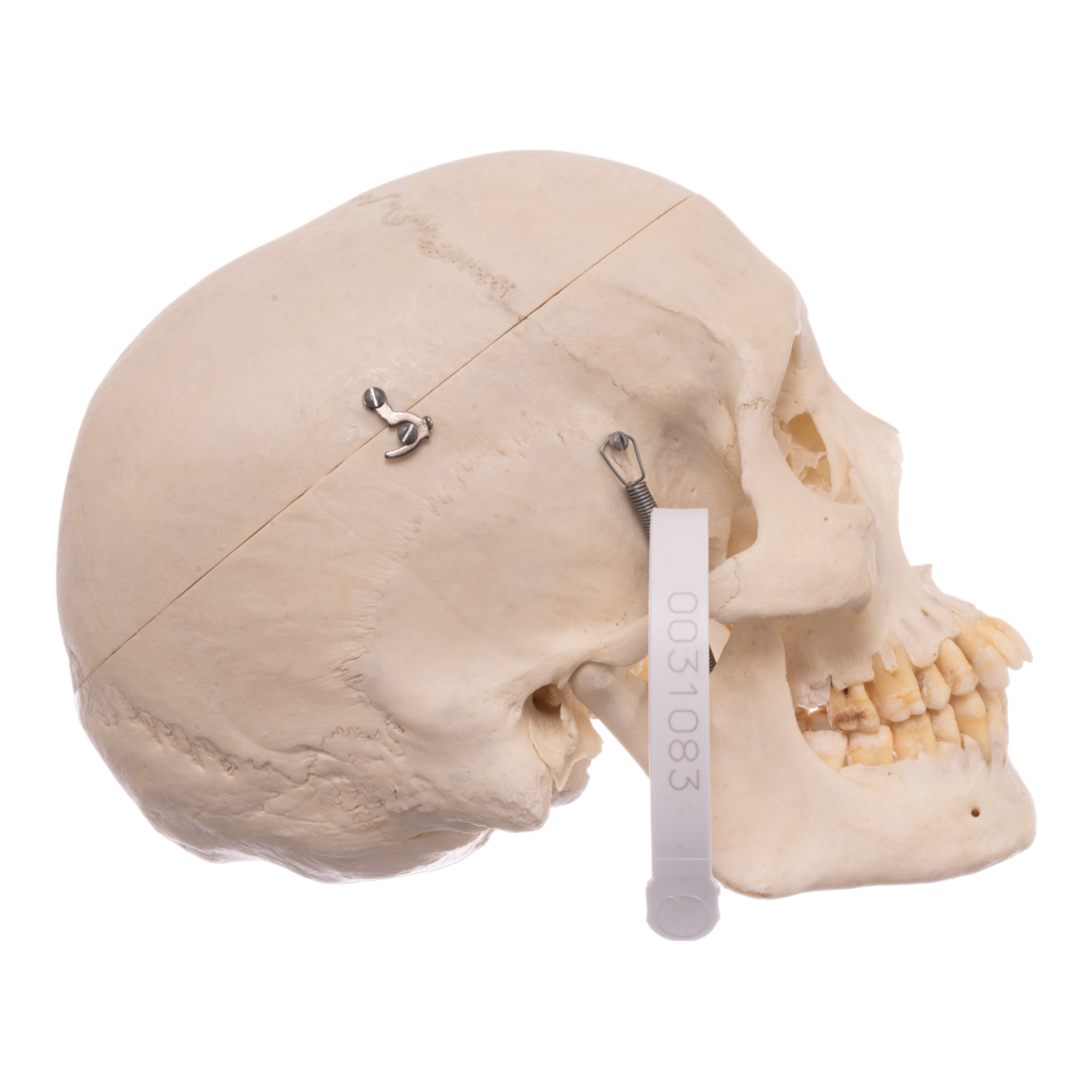 Real Human Skeleton - Articulated Antique — Skulls Unlimited International,  Inc.