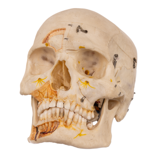 Real Human Skull with Carrying Case - Dissected