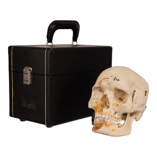 Real Human Skull with Carrying Case - Dissected