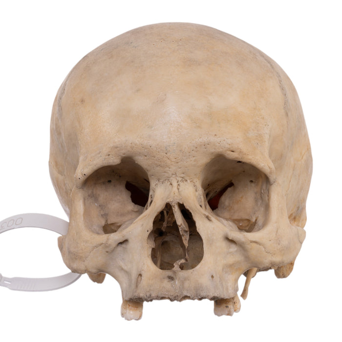 Real Human Skull