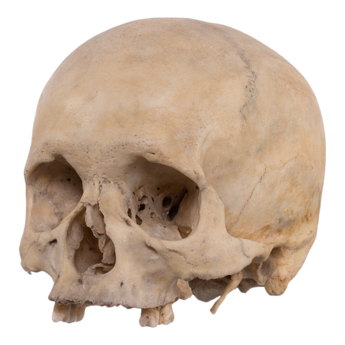 Real Human Skull