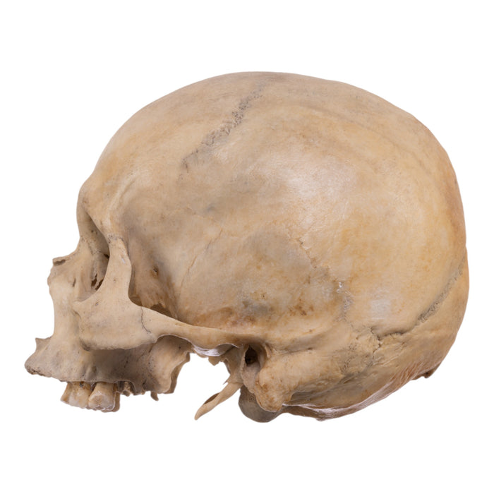 Real Human Skull