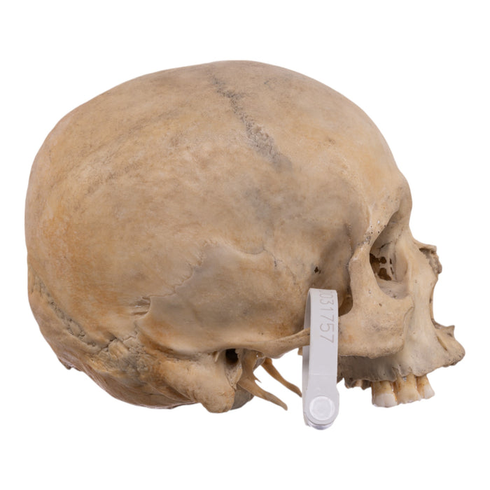 Real Human Skull