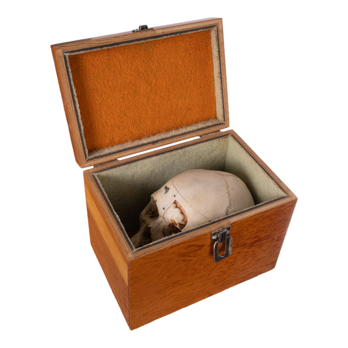 Real Human Dissected Skull with Carrying Case