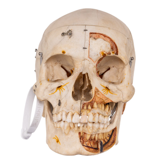 Real Human Dissected Skull with Carrying Case