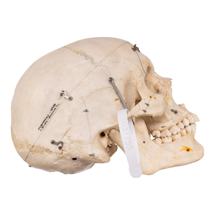 Real Human Dissected Skull with Carrying Case