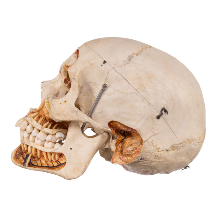 Real Human Dissected Skull with Carrying Case