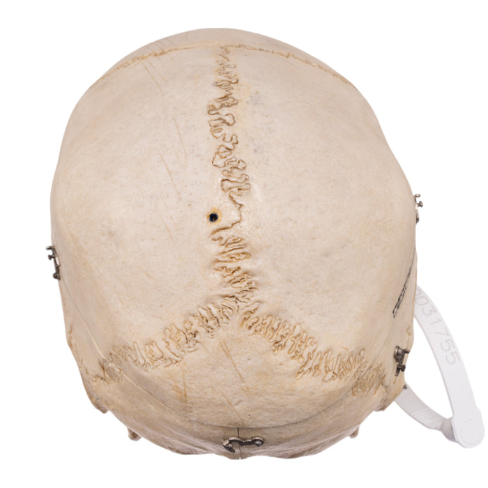 Real Human Dissected Skull with Carrying Case