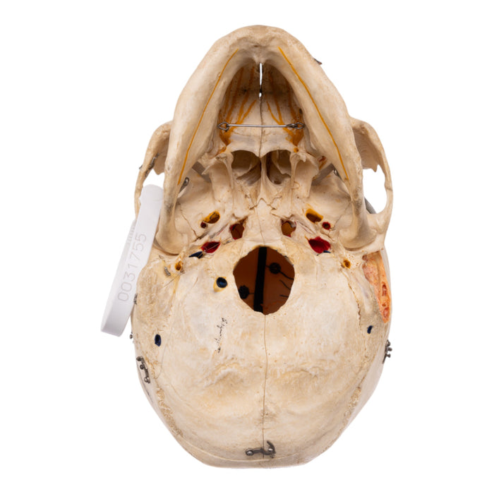 Real Human Dissected Skull with Carrying Case