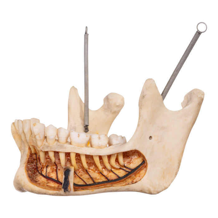 Real Human Dissected Skull with Carrying Case