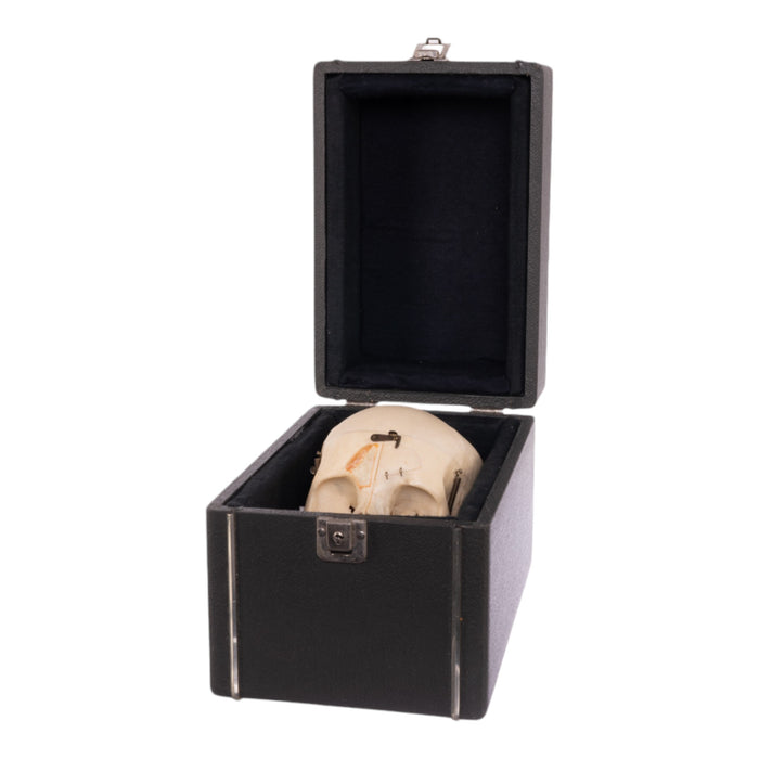 Real Human Dissected Skull with Carrying Case