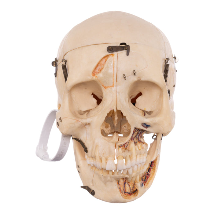 Real Human Dissected Skull with Carrying Case