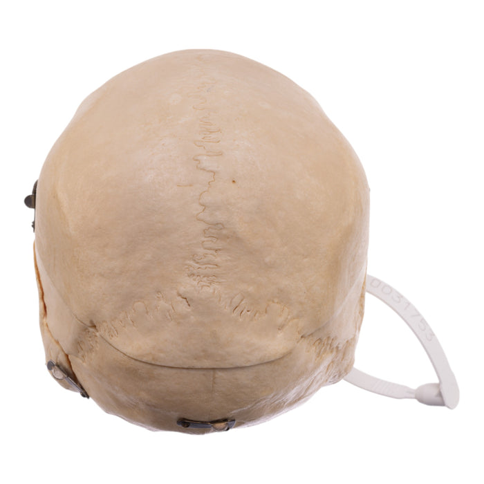 Real Human Dissected Skull with Carrying Case