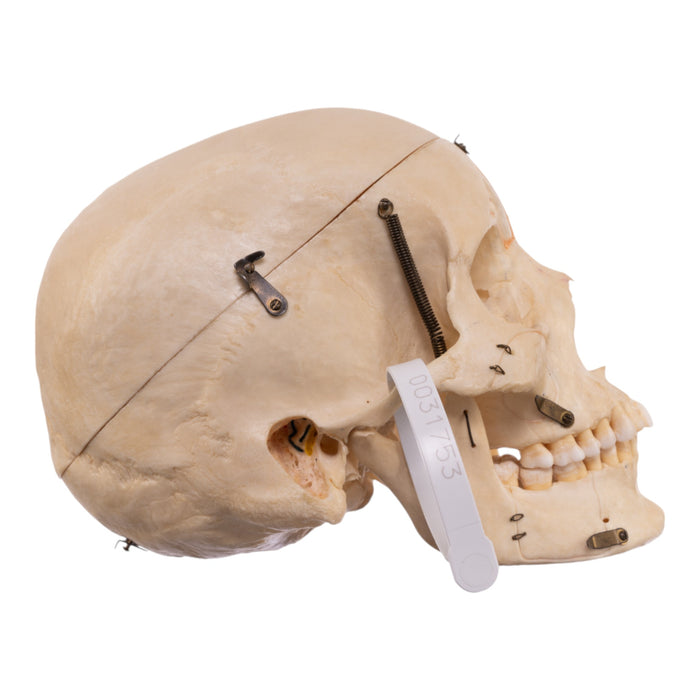 Real Human Dissected Skull with Carrying Case