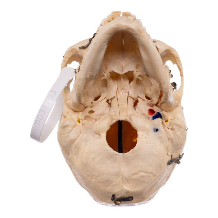 Real Human Dissected Skull with Carrying Case