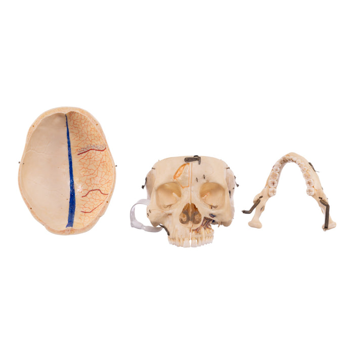 Real Human Dissected Skull with Carrying Case