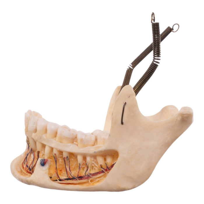 Real Human Dissected Skull with Carrying Case