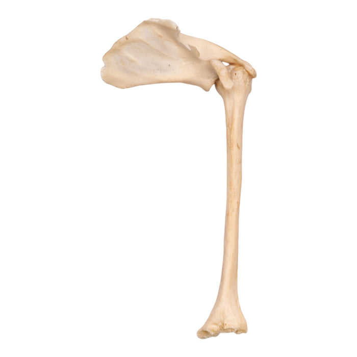 Real Human Humerus with Scapula - Damaged