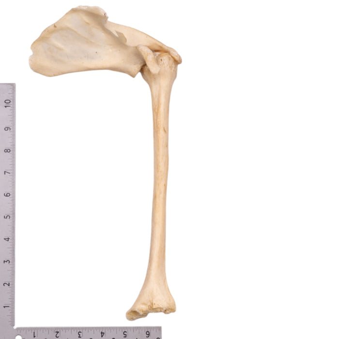 Real Human Humerus with Scapula - Damaged