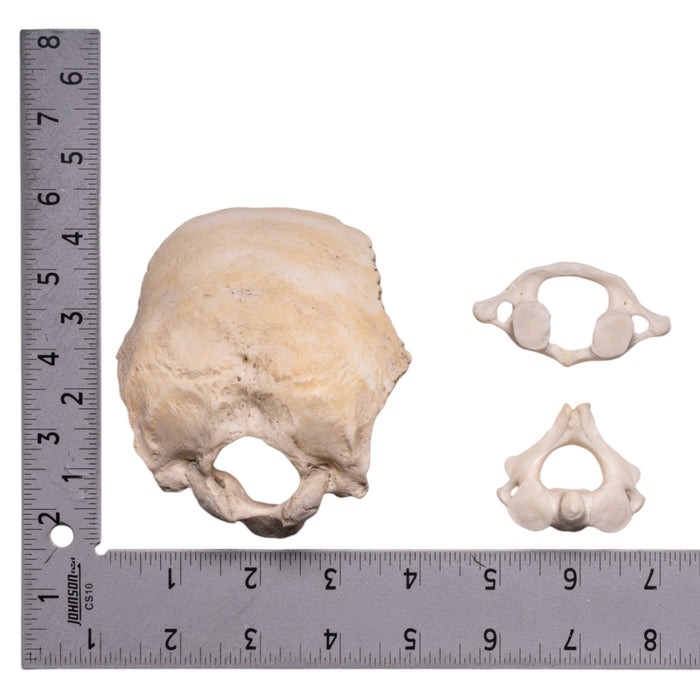 Real Human Occipital Bone, Axis, and Atlas