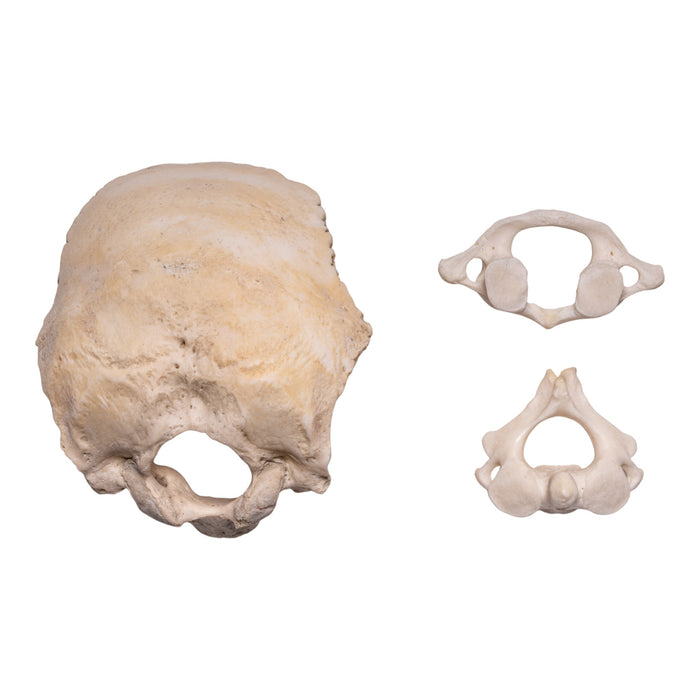 Real Human Occipital Bone, Axis, and Atlas