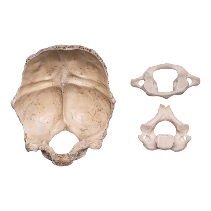 Real Human Occipital Bone, Axis, and Atlas