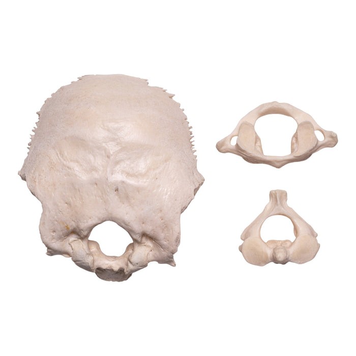 Real Human Occipital Bone, Axis, and Atlas