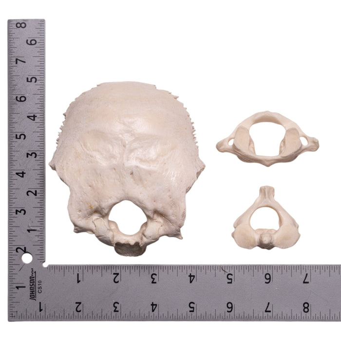 Real Human Occipital Bone, Axis, and Atlas