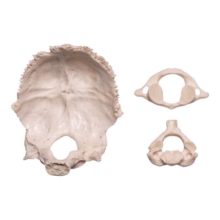 Real Human Occipital Bone, Axis, and Atlas