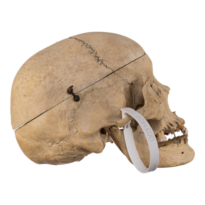 Real Human Skull For Sale — Skulls Unlimited International, Inc.