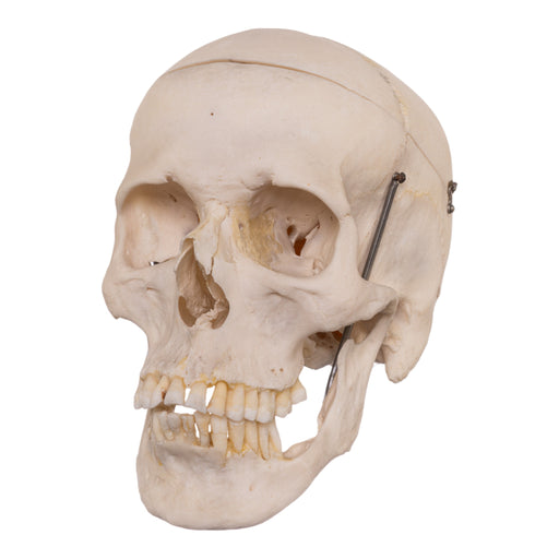 Real Human Skull