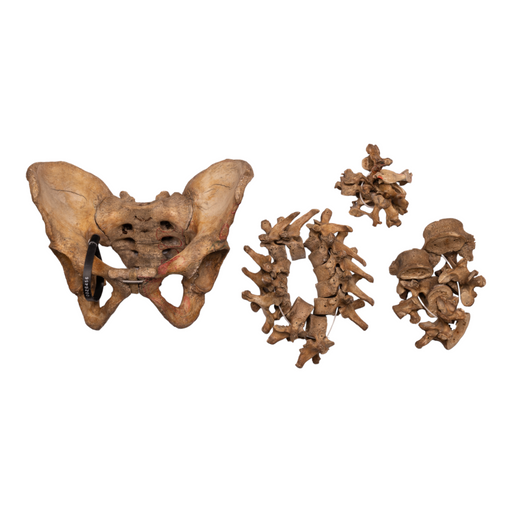 Real Human Spine, Pelvis, and Sacrum