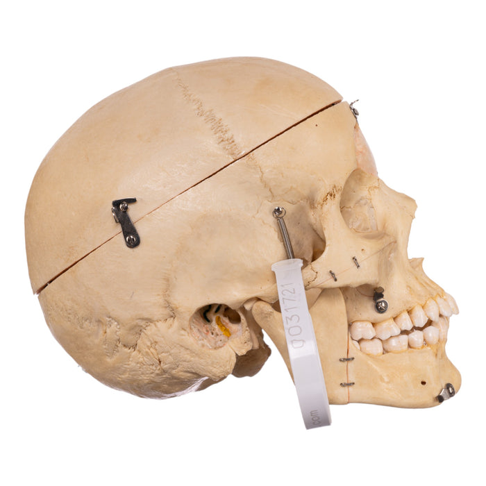 Real Human Dissected Skull With Carrying Case