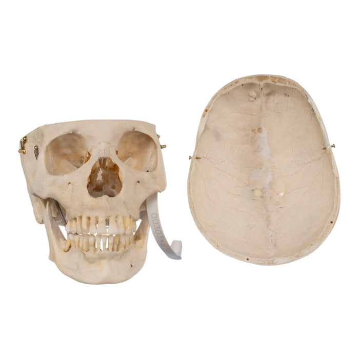 Real Human Skull