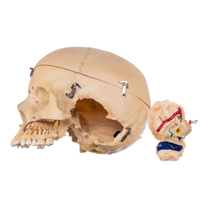 Real Human Dissected Skull With Carrying Case