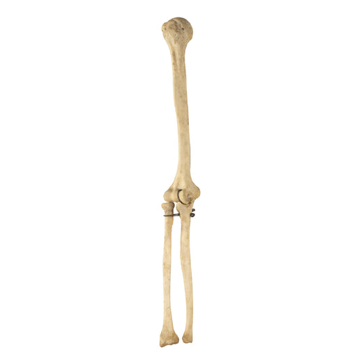 Real Human Humerus, Radius, and Ulna